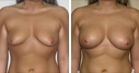 Before & After Photos